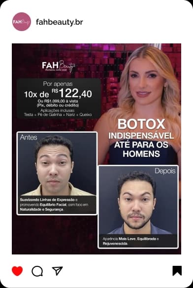 Armonização Facial em Araçatuba