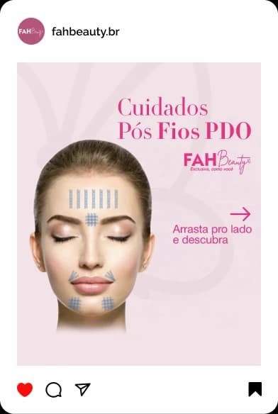 Armonização Facial em Araçatuba