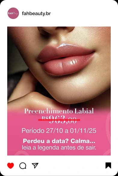 Armonização Facial em Araçatuba